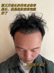 -雍禾植发全国连锁