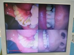 -深圳乐孚正强口腔诊所(宝体店)