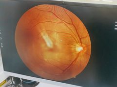 -宝岛眼镜(苏州浒关店)