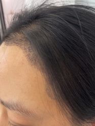 -熙朵美学植发·连锁品牌