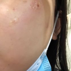 体验后-伊丽莎白医疗美容