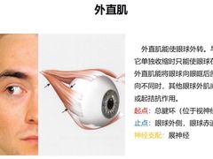 -黑马眼科·近视手术