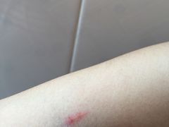 -深圳市人民医院(留医部)