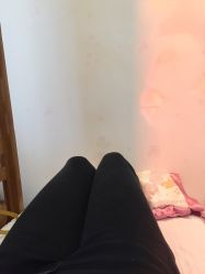 -成都苗方清颜专业祛痘