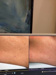 -苑苑vbeauty科技美容SPA