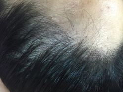 刚做完发际线很真哦！-平萍纹绣韩式半永久定妆