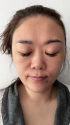 体验前-北京炫美医疗美容