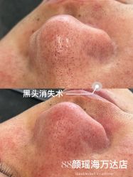 -Cream88颜皮肤管理中心