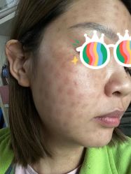 -海涛医疗美容·面部抗衰·注射美鼻