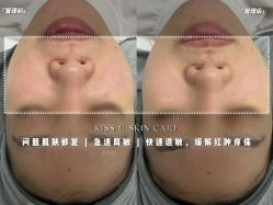 -KISS U 国际美学