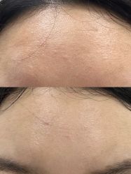 体验前-南京医科大学友谊整形外科医院