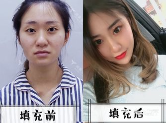 20岁看起来像40岁真的一点不夸张！