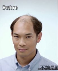 -发饰美男士增发补发假发定制店