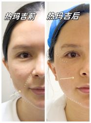 -深圳艺星医疗美容医院
