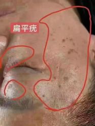 -香薇妮丝·定制减肥·身材管理