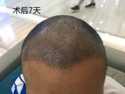 -雍禾植发全国连锁