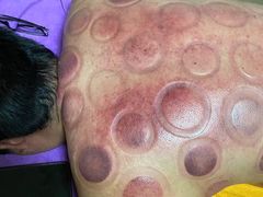 -沈师傅盲人按摩工作室(密三小区店)