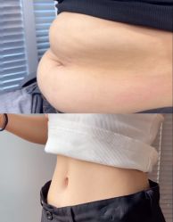 -Fundi张玉珊修身堂·indiba·BTL科技瘦身