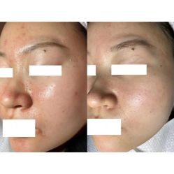 -美肤盾祛痘·问题肌头疗管理中心