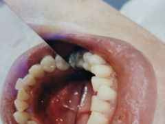 -宁波壹加壹口腔·矫正种植中心