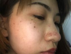 -上海玫瑰医疗美容医院