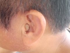 -自然之声助听器·呼吸机(保定清苑店)