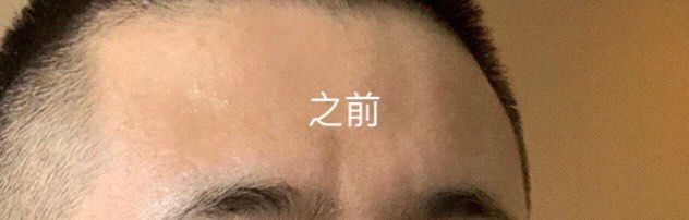 -八大处整形