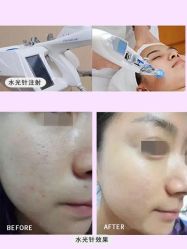 -北京米扬丽格医疗美容·联合丽格鼻整形中心