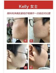 -安吉拉青春化管理中心
