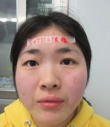 -素美医疗美容·西南眼鼻整形·修复基地