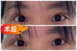 -素美医疗美容·西南眼鼻整形·修复基地