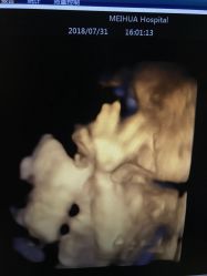 -杭州贝瑞斯美华妇儿医院·早孕·产检·儿科