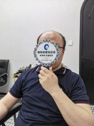 -唐风采假发补发定制