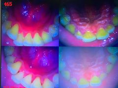 -土豆口腔(凤凰北总店)