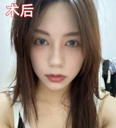 -素美医疗美容·西南眼鼻整形·修复基地
