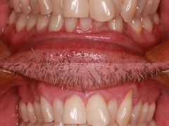 -泰康拜博口腔医院(海曙店)