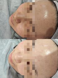 -SKIN79皮肤管理中心