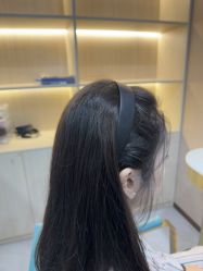-碧莲盛不剃发植发