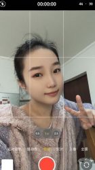 体验后-联合丽格·张菡丽格医疗美容