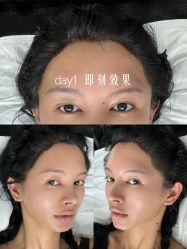 -雍禾植发全国连锁