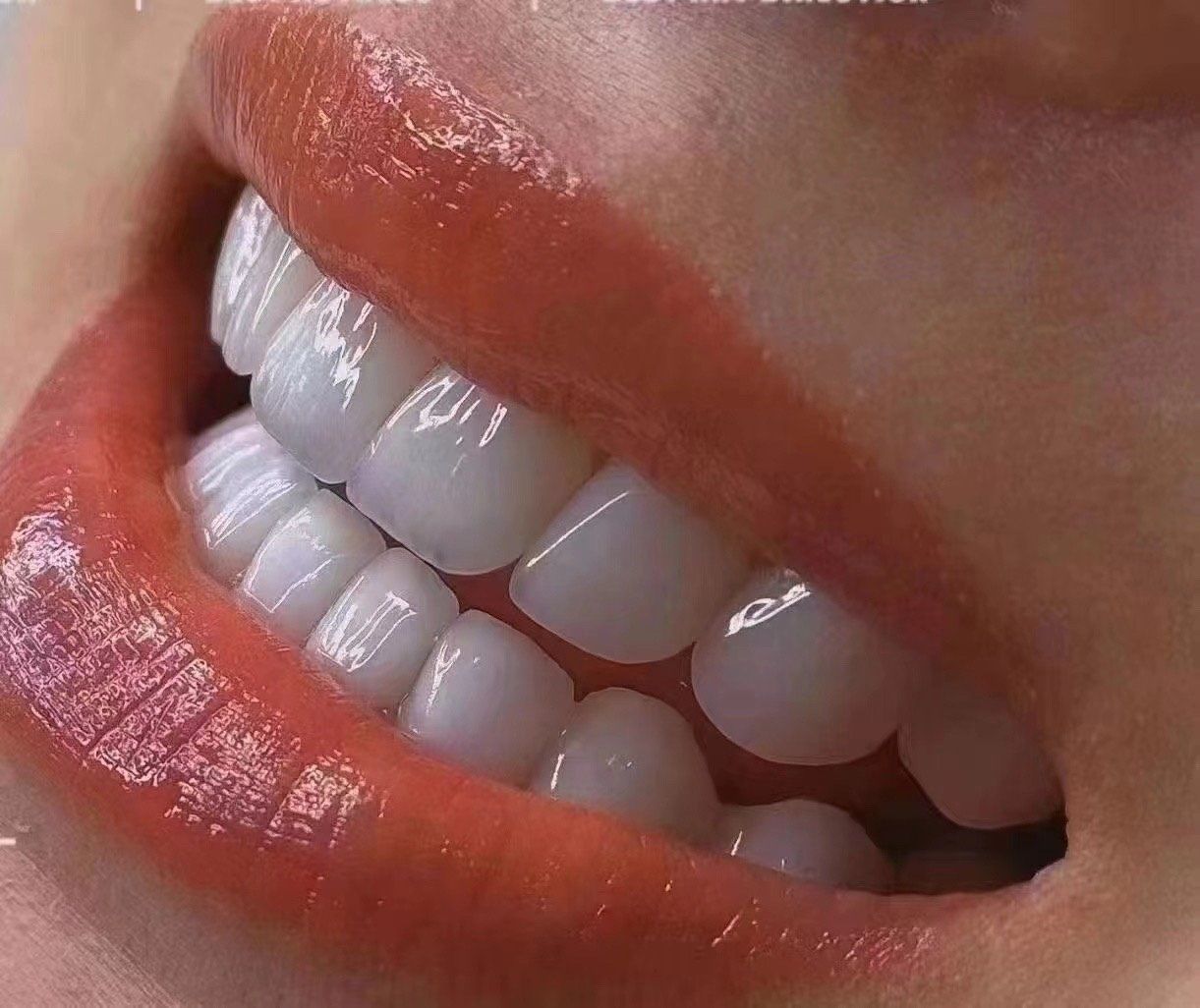 牙齿白白的真的能让人心情变好!