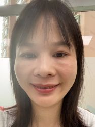 体验后-深圳美莱医疗美容医院