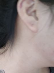 -素美医疗美容·西南眼鼻整形·修复基地