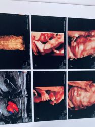 -杭州医学院附属妇儿医院