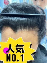 点击看大图 -大麦微针植发全国连锁
