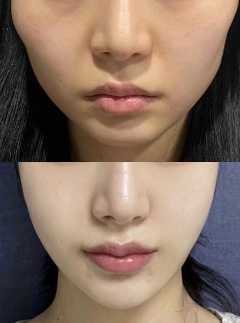 大家帮我看看磨骨做的值不值?