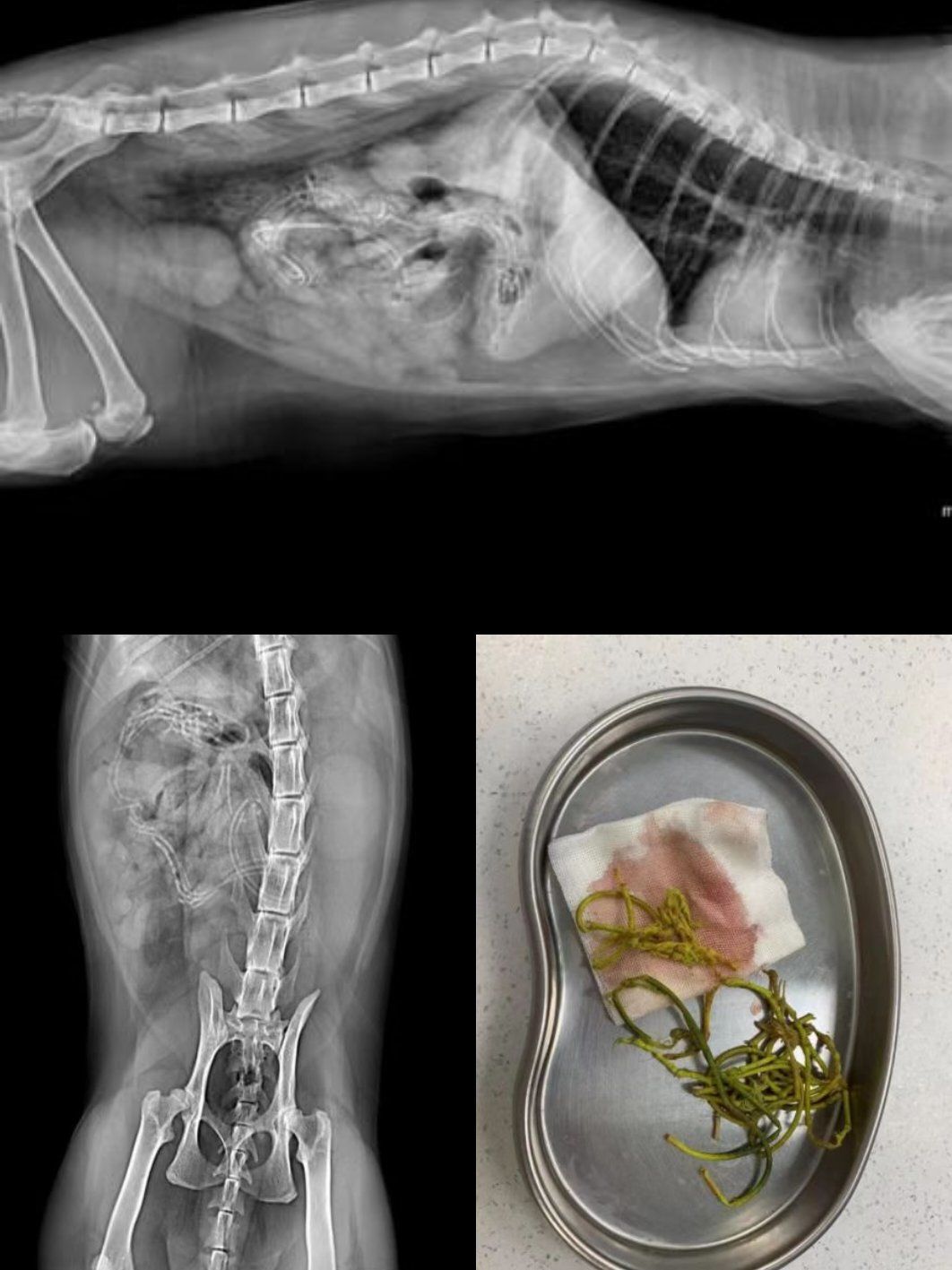 频繁呕吐不吃东西,精神状态差,触诊腹部敏感,拍片钡餐造影发现线性