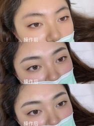 -久匠·野生眉半永久纹眉