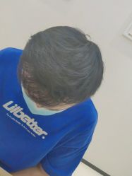 -雍禾植发全国连锁