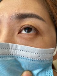 -美丽人生祛斑扁平疣汗管瘤中心